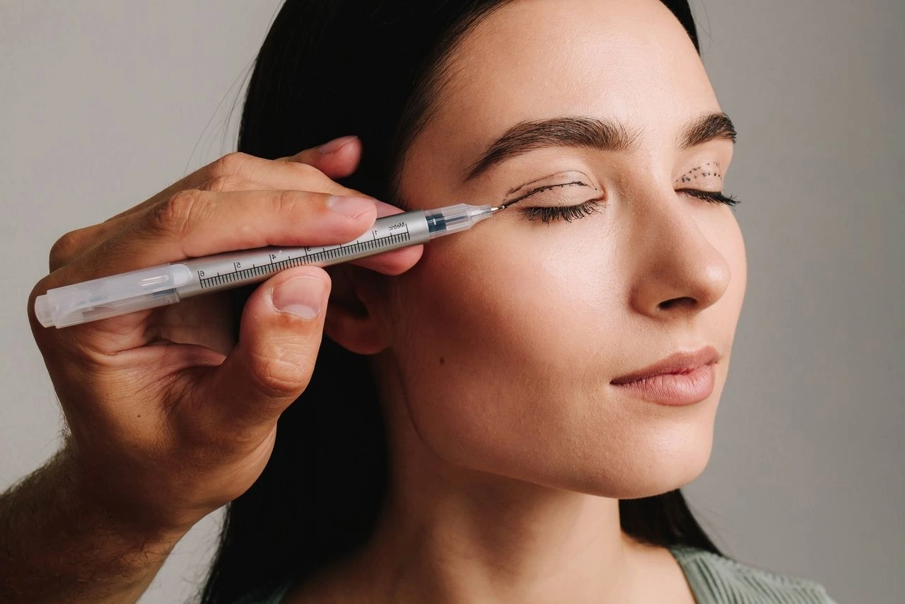 A provider uses a surgical marking pen to draw pre-procedure guidelines on a woman's eyelid before blepharoplasty