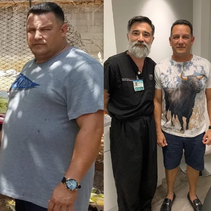 Man in a gray t-shirt before bariatric surgery, then slimmer standing with Dr. Keshavarzi in the office