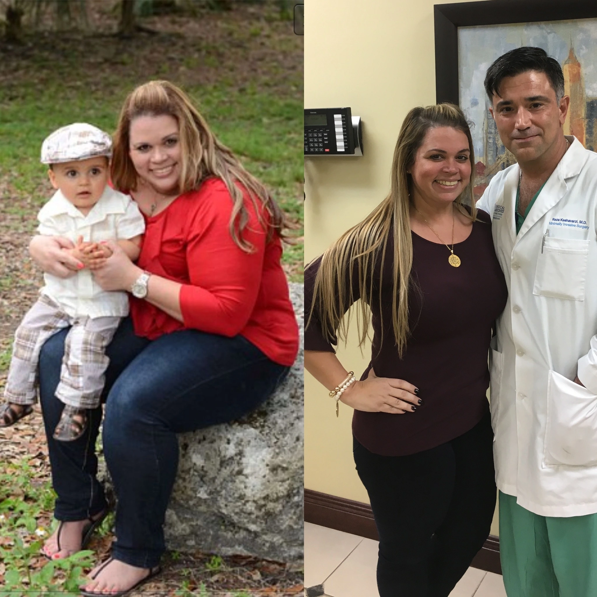 Mother holding her child before weight loss surgery and later standing with Dr. Keshavarzi after weight loss
