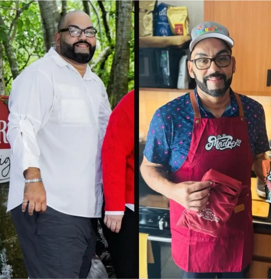Before and after bariatric surgery: a man in a white shirt, then noticeably slimmer wearing an apron in a kitchen