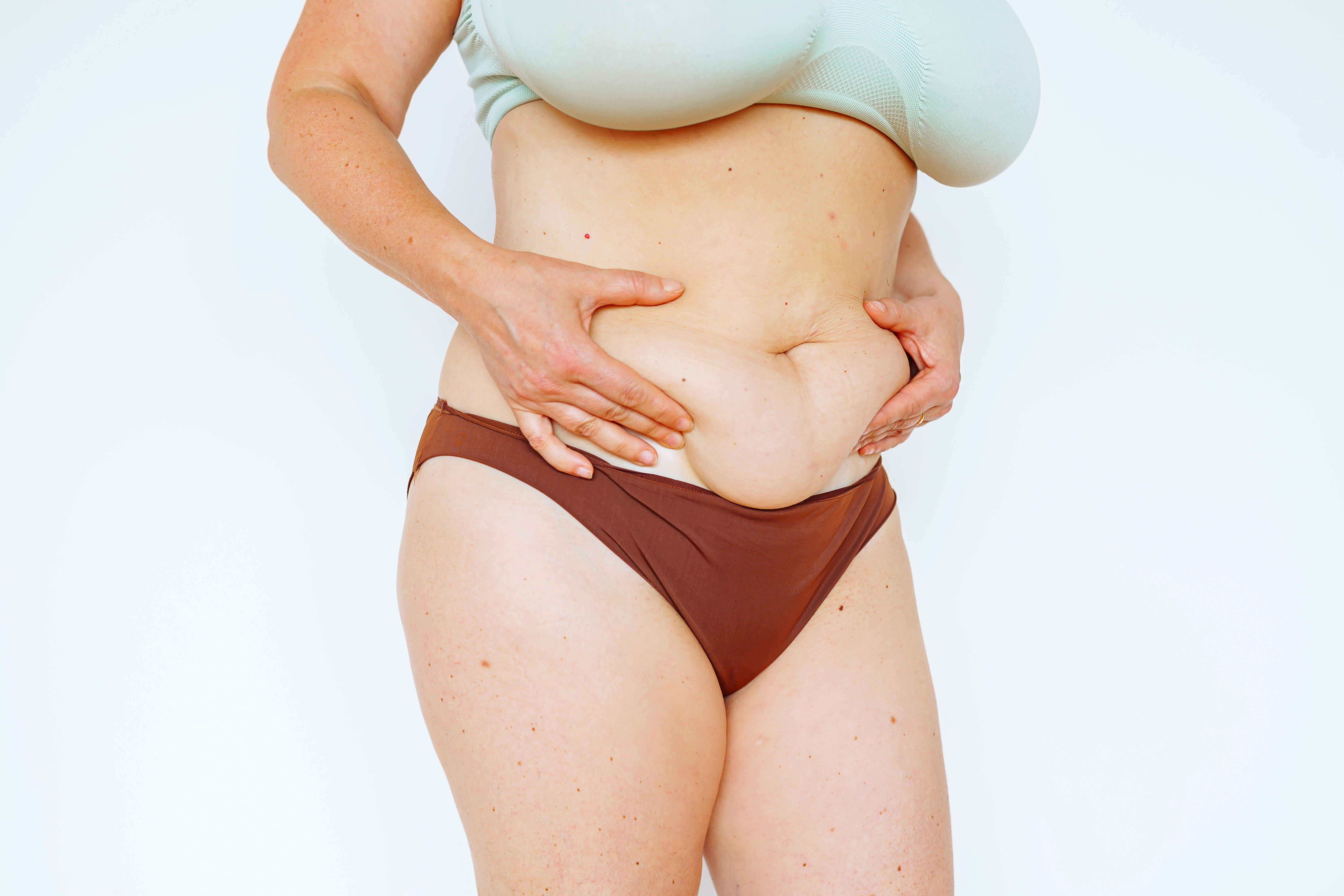 Cropped photo of a woman's midsection pinching excess loose abdominal skin, illustrating body changes after weight loss relev