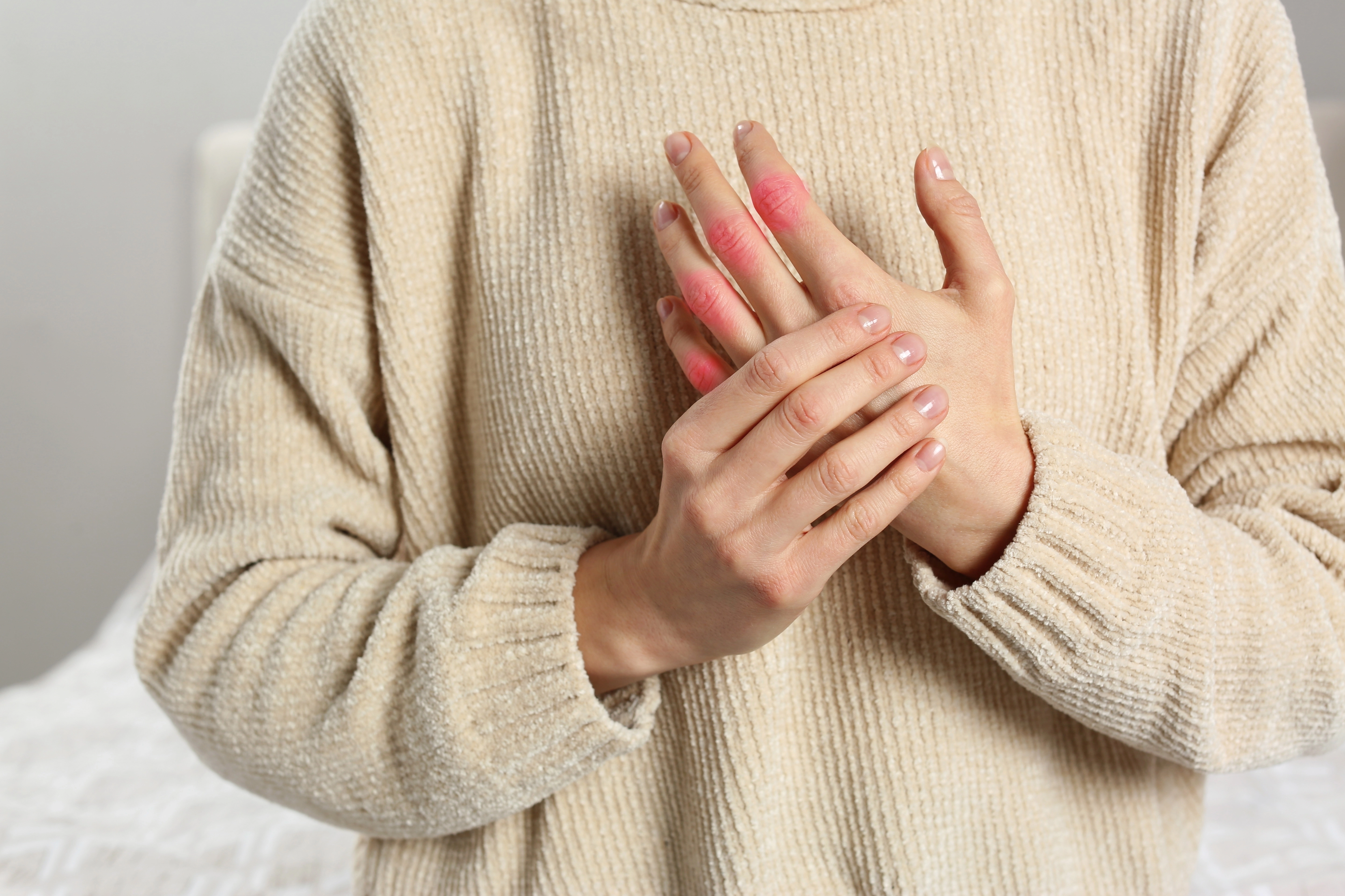 Person in a beige sweater holding hands with reddened, inflamed finger joints
