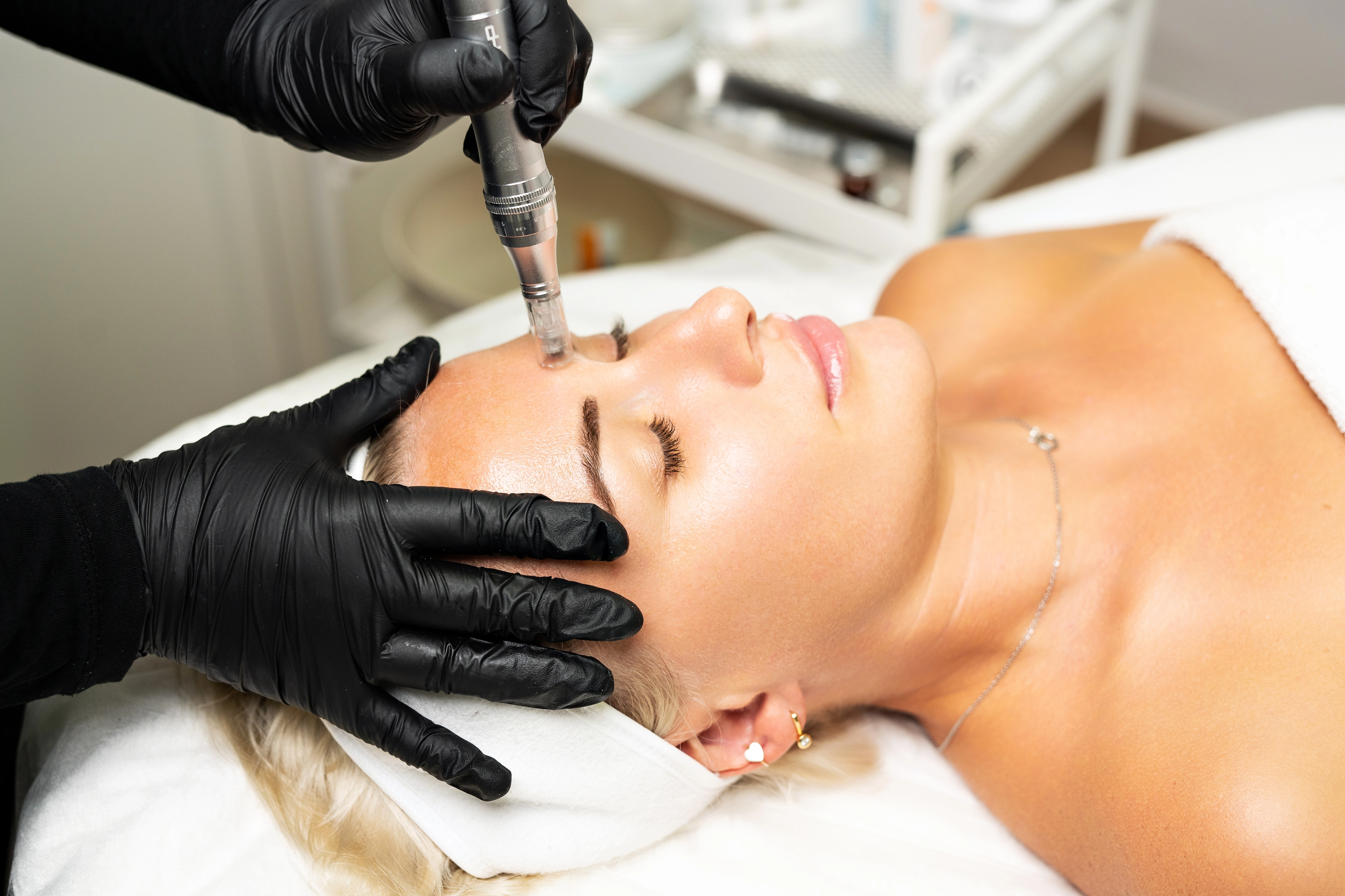 A woman receives a microdermabrasion or microneedling facial treatment from a gloved practitioner, illustrating a blog post a