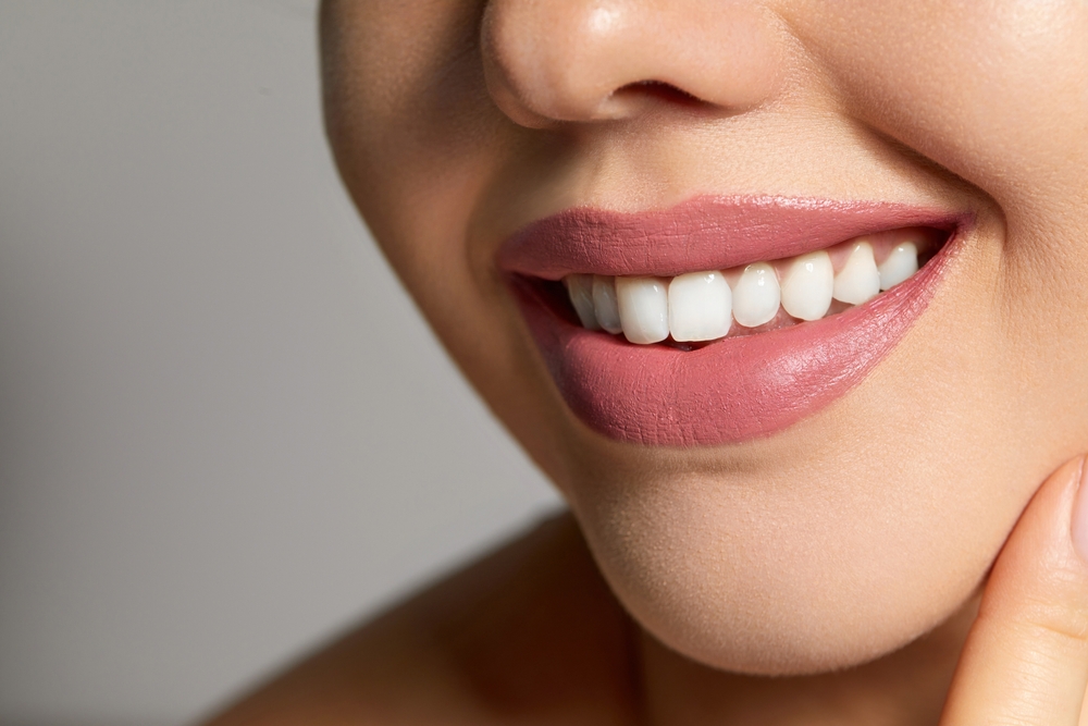 Extreme close-up of a woman's smile showing white teeth and burgundy lipstick, used to illustrate a smile makeover