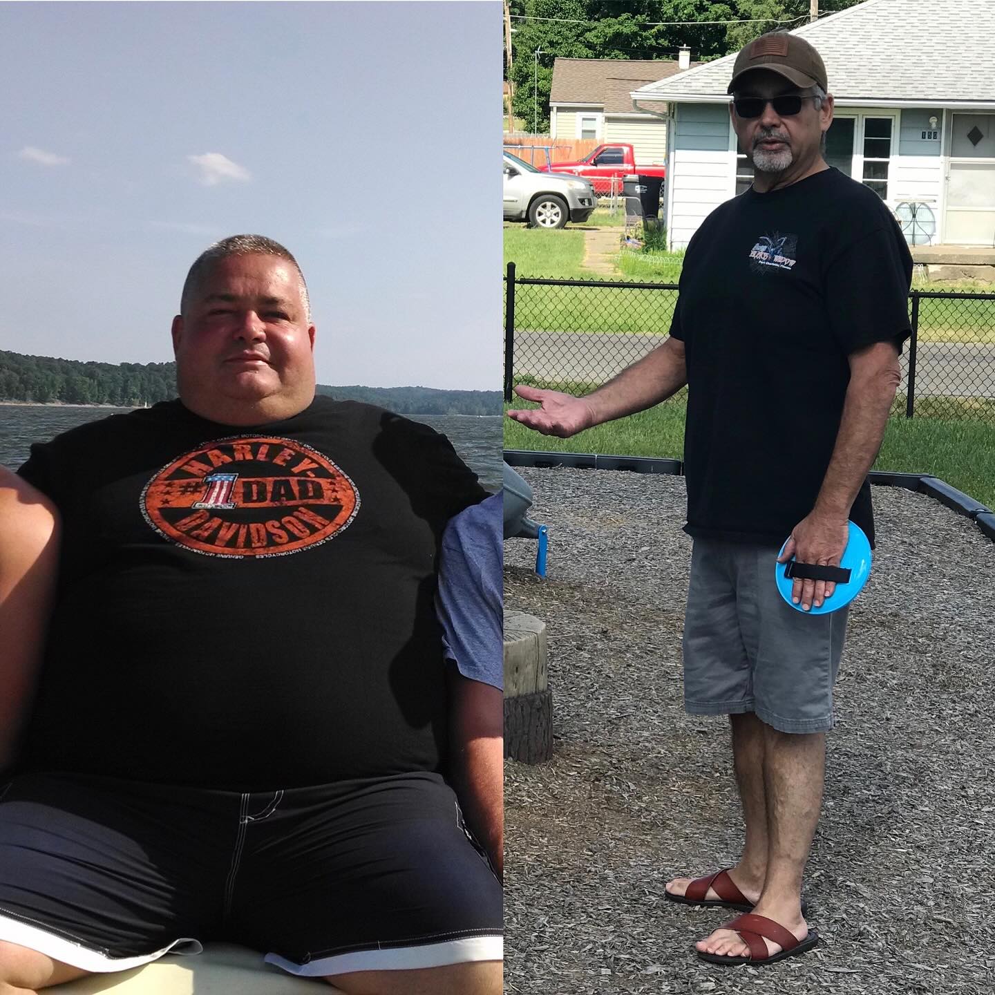 Before and after bariatric surgery: a man in a black graphic tee, then noticeably slimmer outdoors in a gray shirt