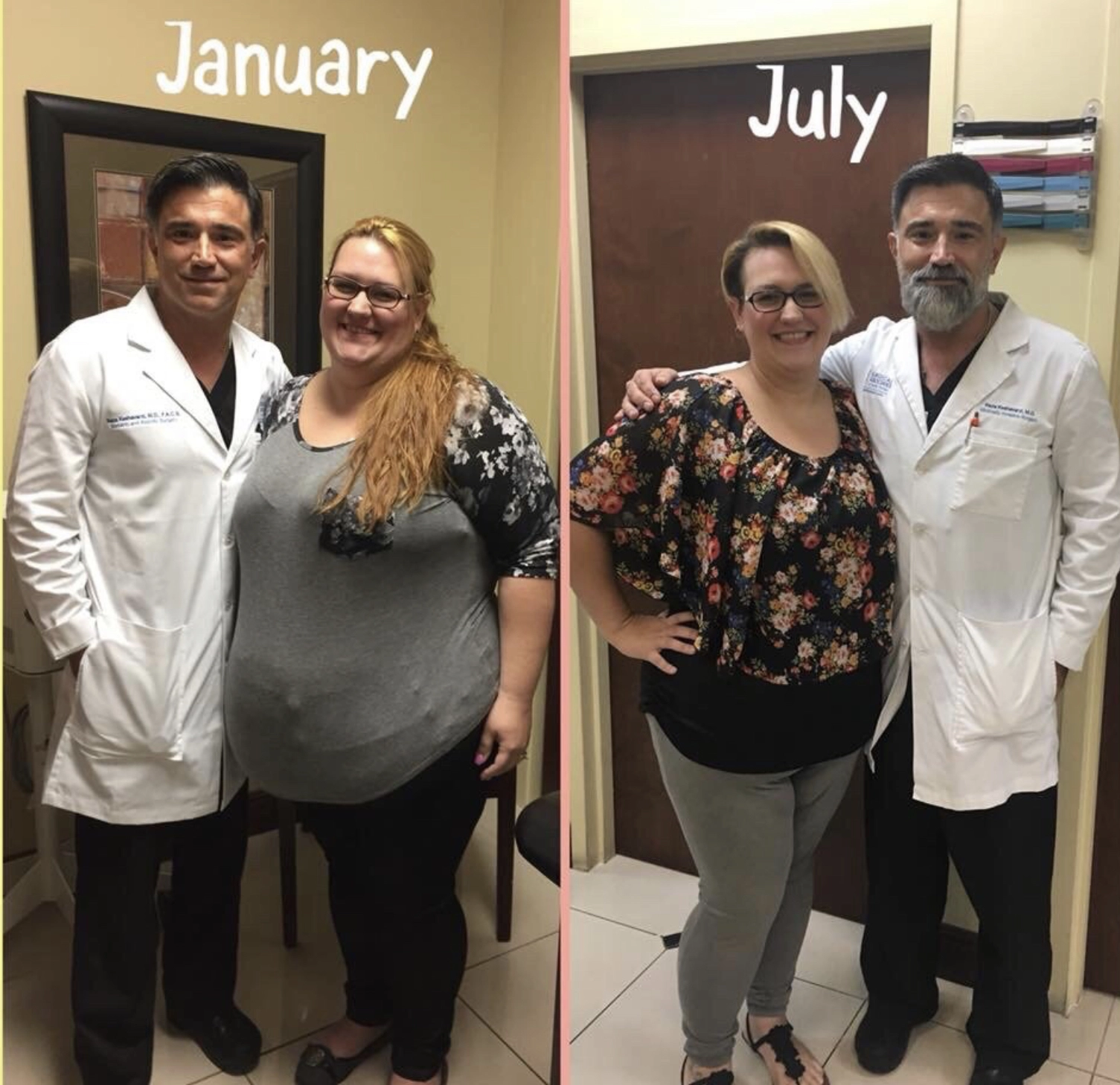 Patient standing with her surgeon in January and again in July after six months of weight loss