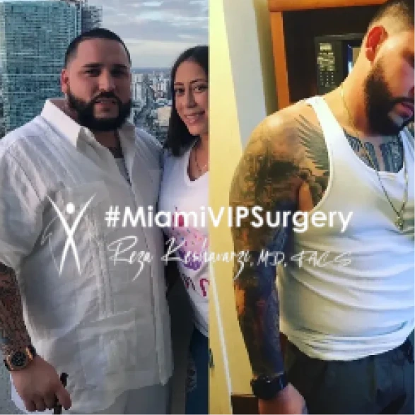 Gastric sleeve before and after of a bearded man in a white shirt, then visibly slimmer in a white tank top