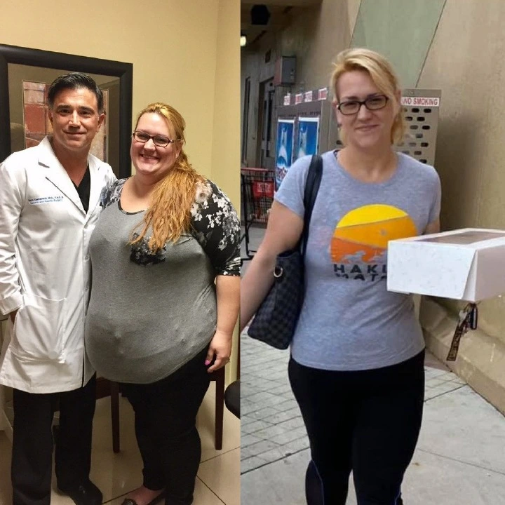 Before and after bariatric surgery: a woman standing beside a surgeon in a white coat, then much slimmer in a gray t-shirt