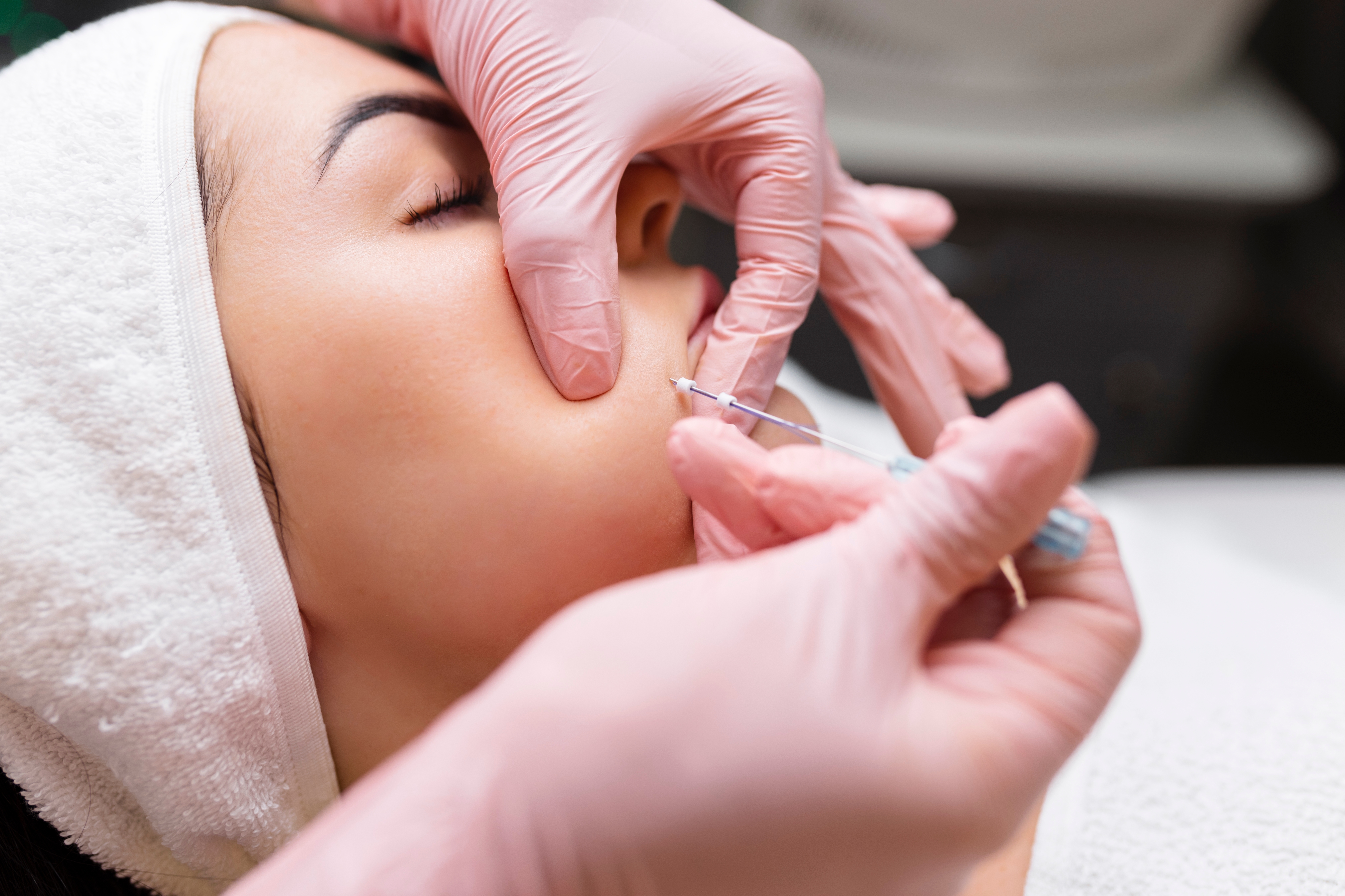 Close-up of a gloved provider administering a facial injection near a patient's mouth during a cosmetic treatment
