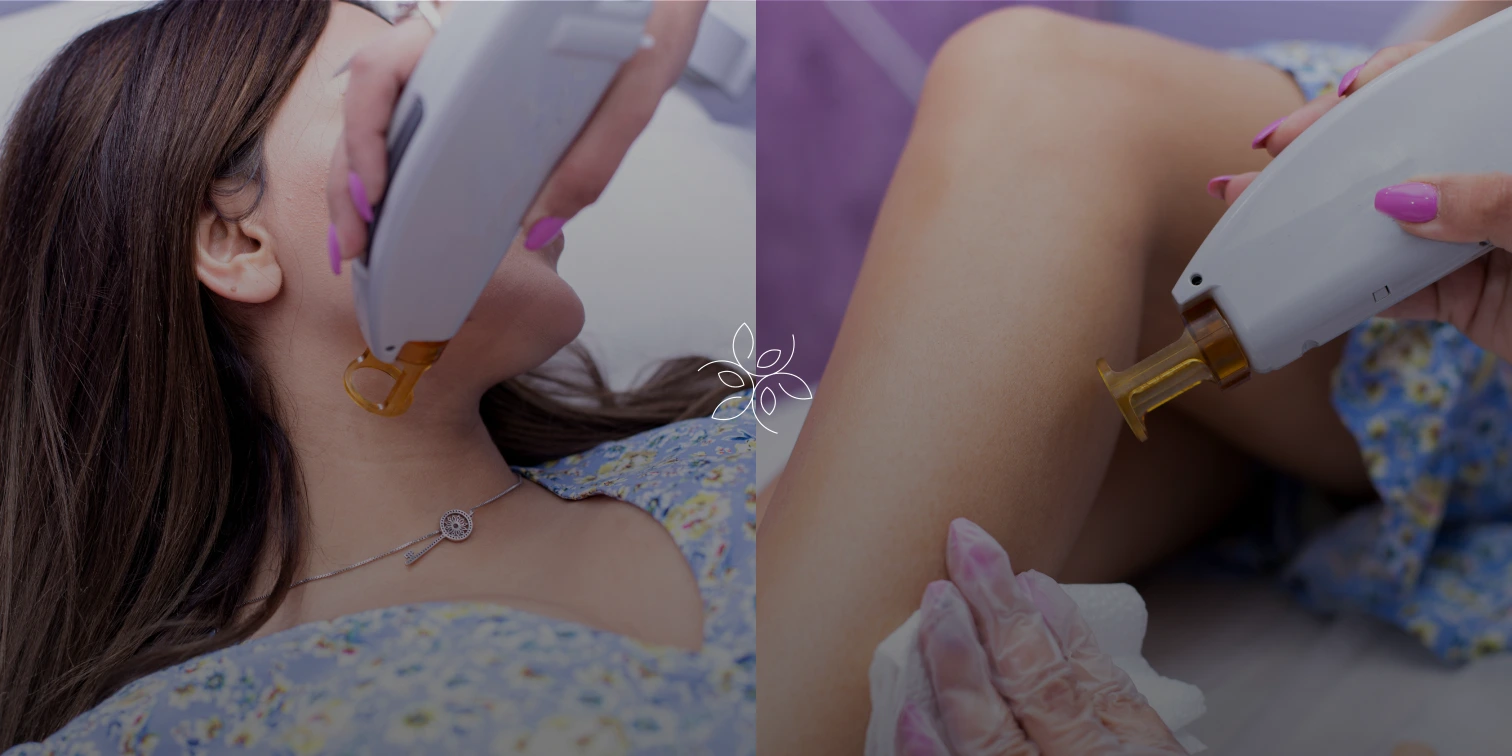 A provider holds a laser handpiece to the side of a patient's neck during a vascular laser treatment