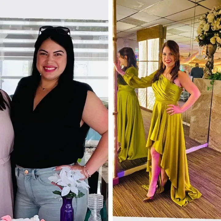 Before and after weight loss surgery: a woman in a black top and jeans, then much slimmer in a long green dress