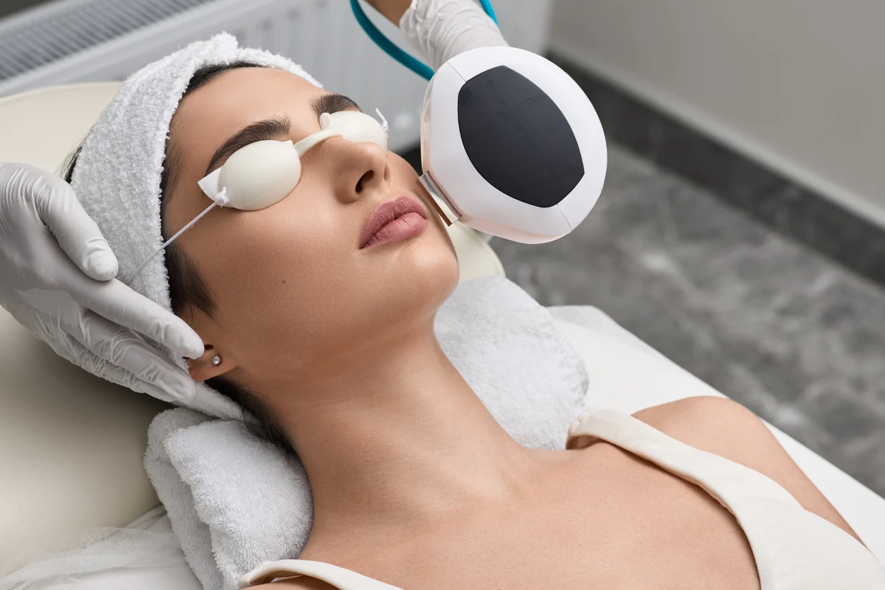 A woman receives a laser skin rejuvenation treatment on her face from a gloved provider in a medical spa setting