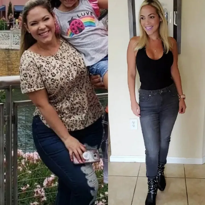 Before and after weight loss surgery: a woman in a leopard print top, then slimmer in a black top and jeans