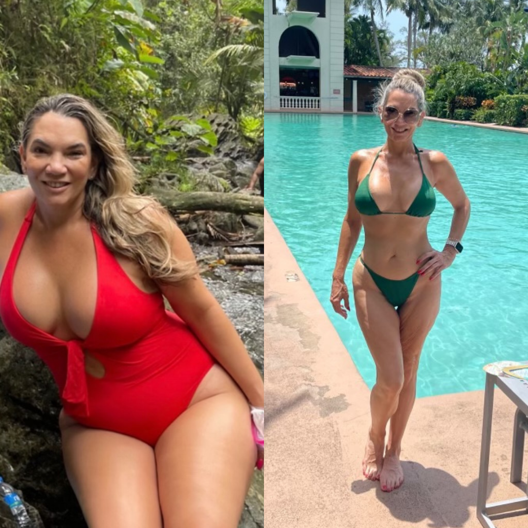 Before and after weight loss surgery: a woman in a red swimsuit, then noticeably slimmer by a pool