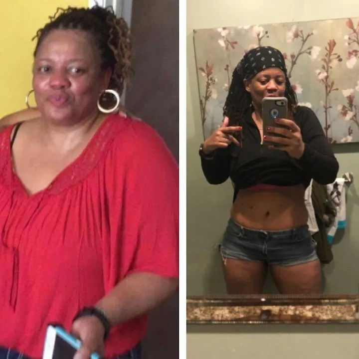 Before and after bariatric surgery: a woman in a red top, then slimmer in a black crop top and denim shorts