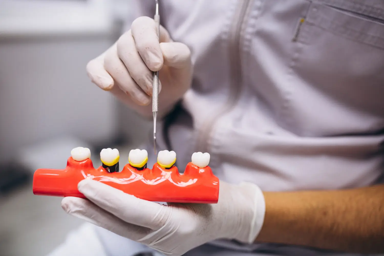 A gloved dental professional holds a tooth model with dental crowns while using a dental instrument