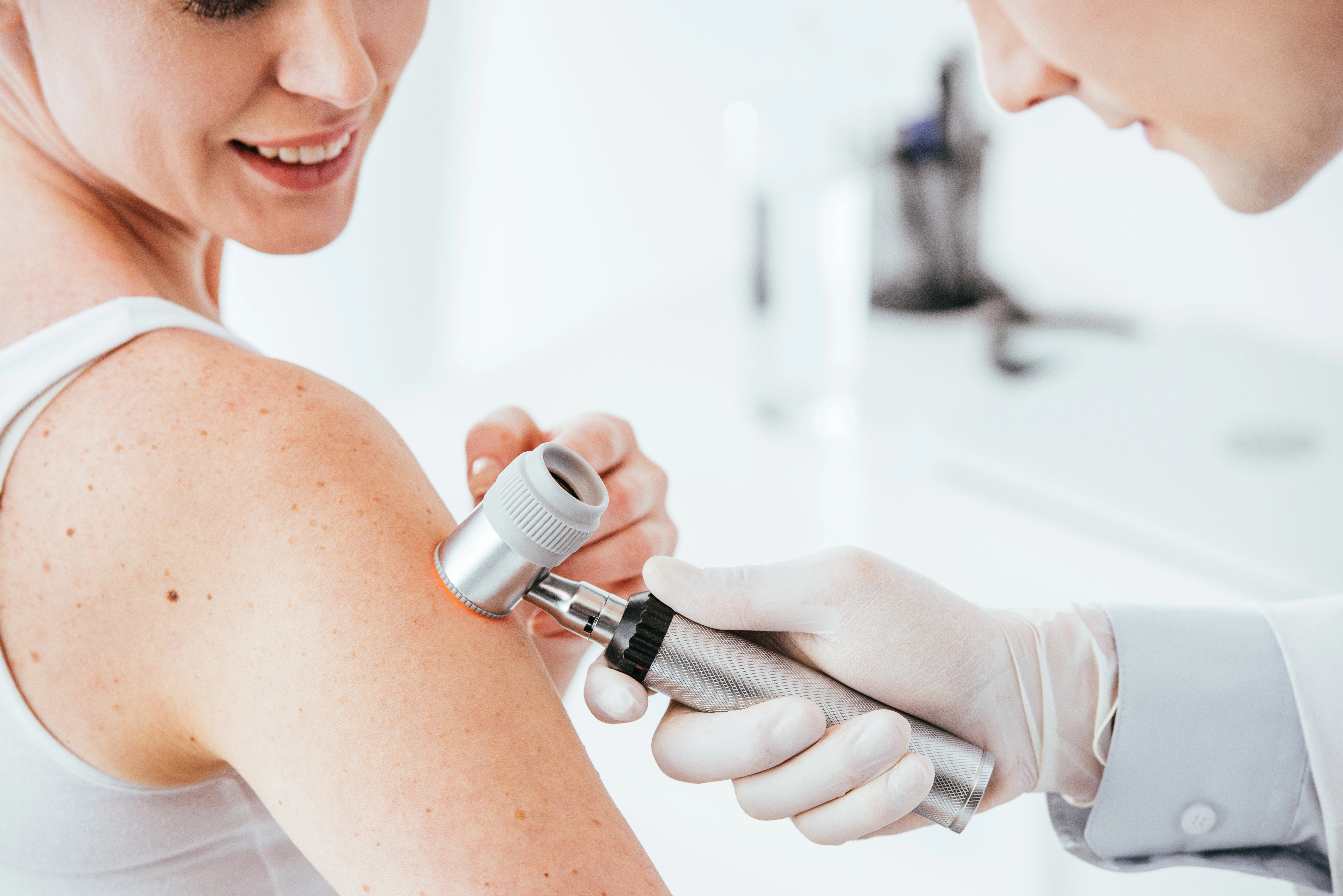 A dermatologist uses a dermatoscope to examine a mole on a patient's shoulder during a skin check.