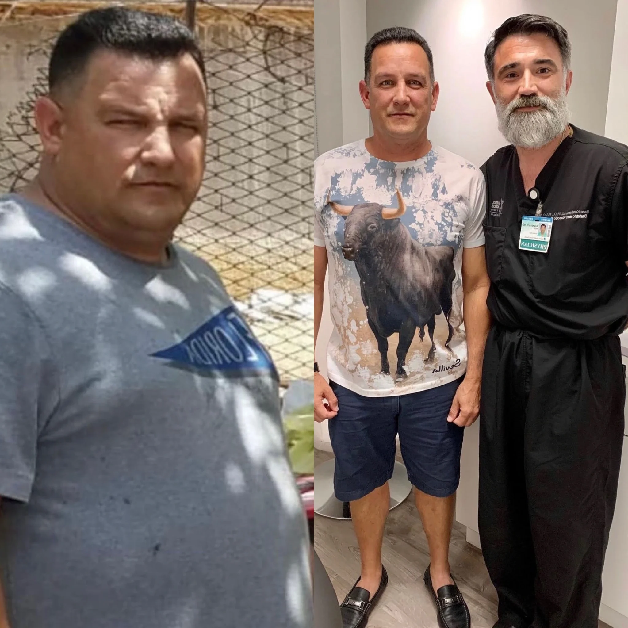 Male patient before bariatric surgery and after weight loss standing beside his surgeon