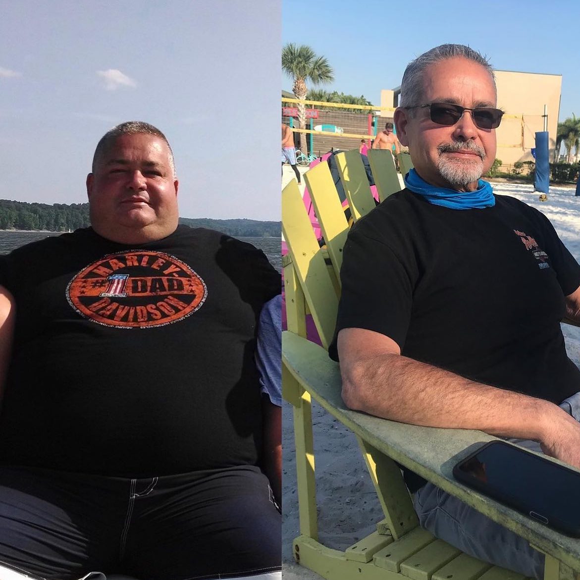 Before and after gastric sleeve surgery: a man in a black t-shirt by the water, then slimmer seated in a beach chair