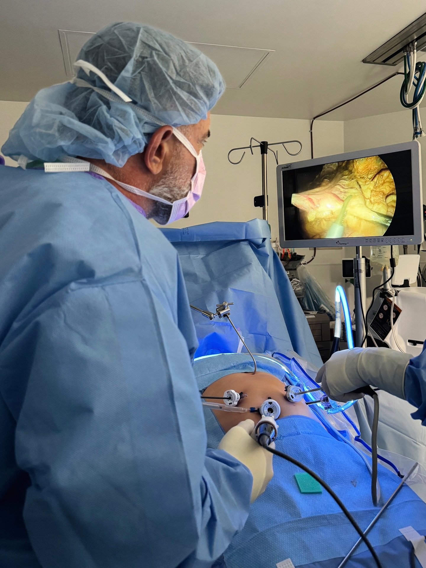 Surgeon performing laparoscopic weight loss surgery while watching the internal camera feed on an operating room monitor