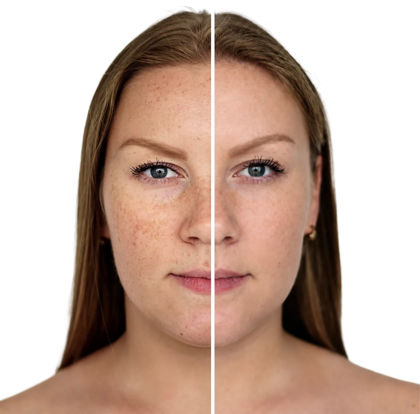 A face split down the middle showing a before and after skin preview
