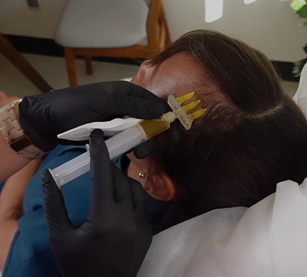 Provider giving a regenerative injection along the hair part