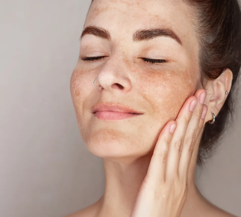 Woman with freckles and uneven pigment smiling with her eyes closed