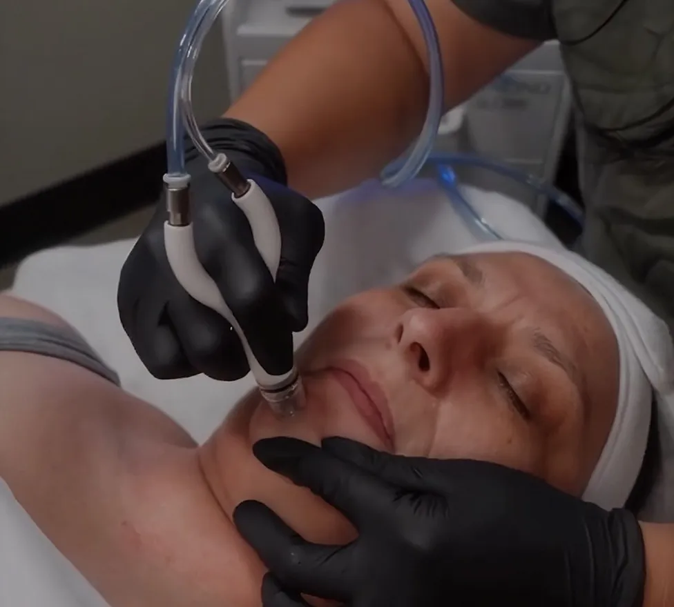 Provider giving a DiamondGlow facial with a handheld wand