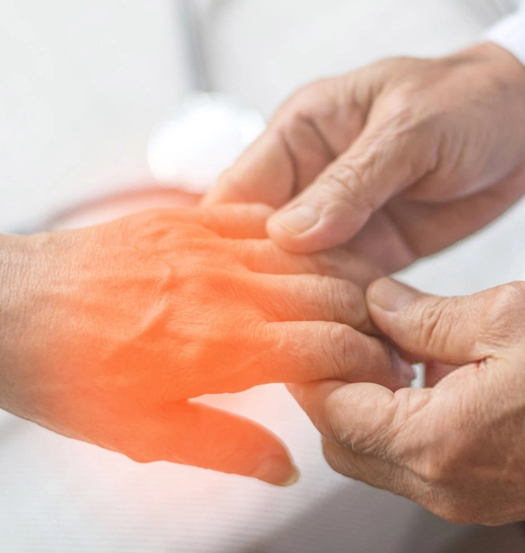 What is Neuropathy Banner