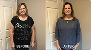 Before and After: Weight Loss