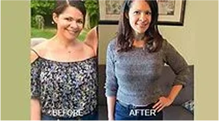 Before and After: Weight Loss