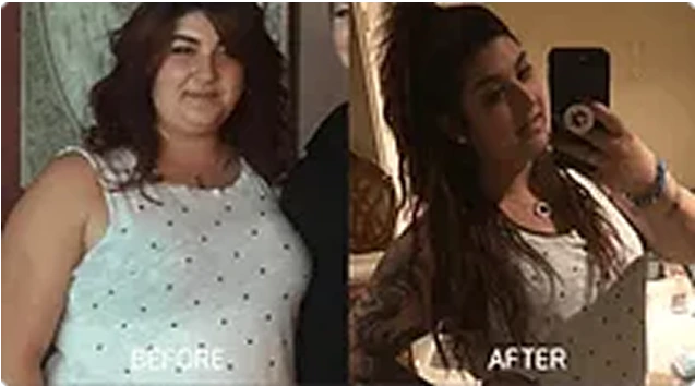 Before and After: Weight Loss