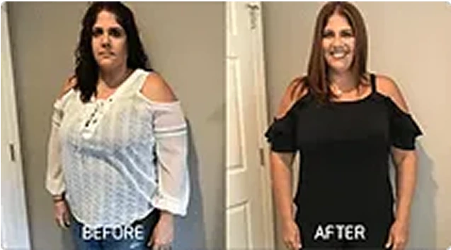 Before and After: Weight Loss