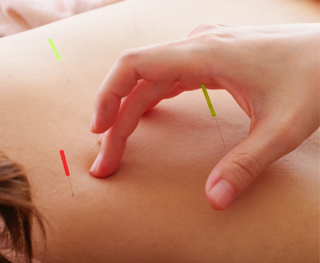 What Is Acupuncture? Banner