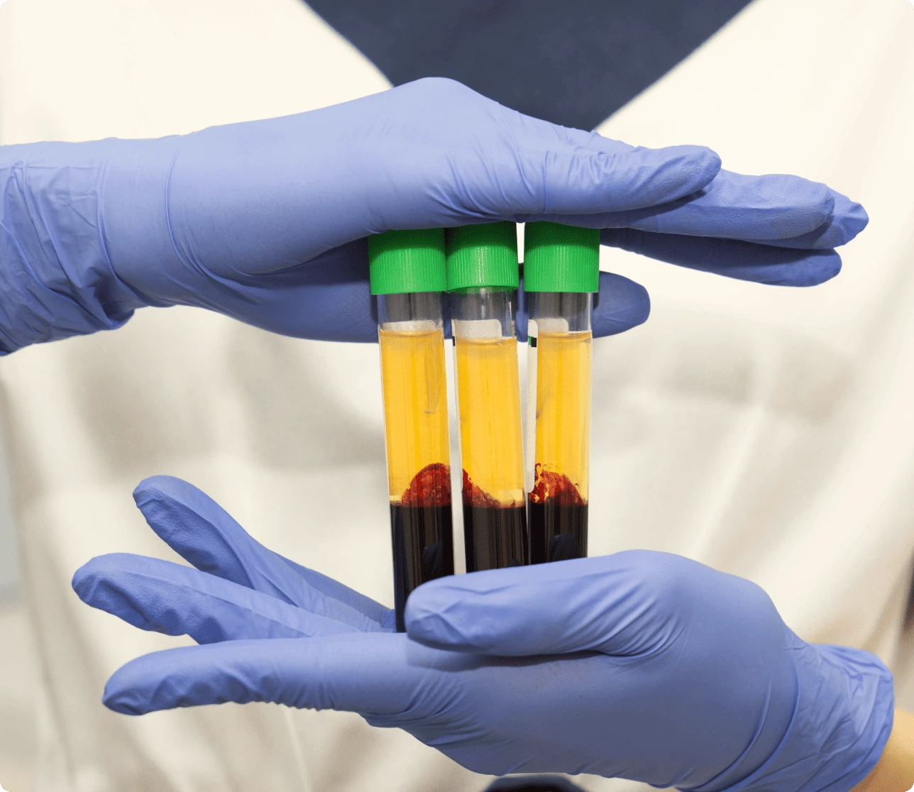 Regenerative-Medicine