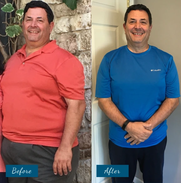 Weight Loss Before & After Banner