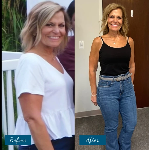 Weight Loss Before & After Banner