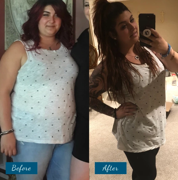 Weight Loss Before & After Banner