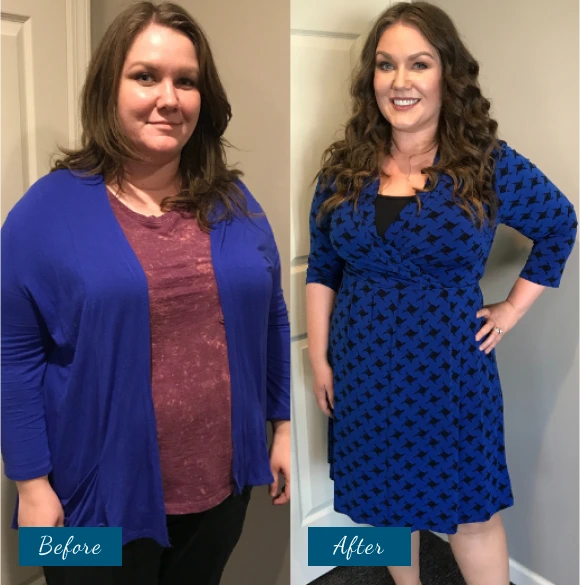 Weight Loss Before & After Banner