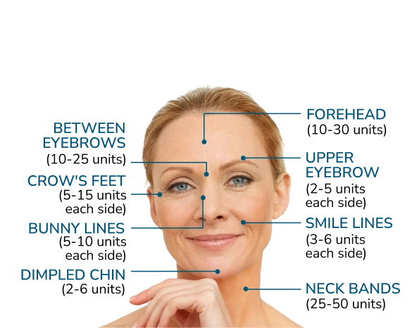 Botox Treatment Areas Banner