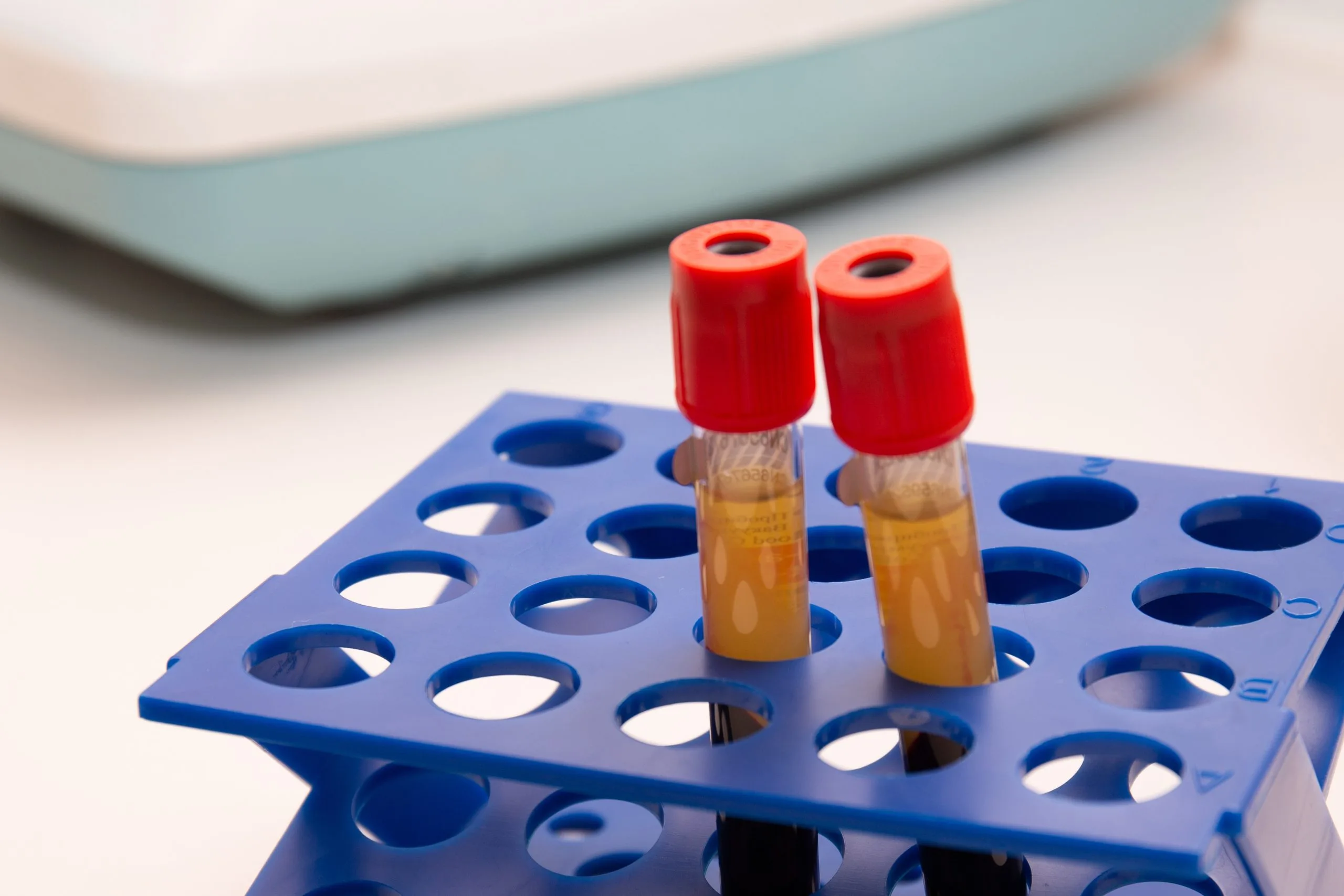 Two blood test tubes with red caps in blue sample rack near tablet device