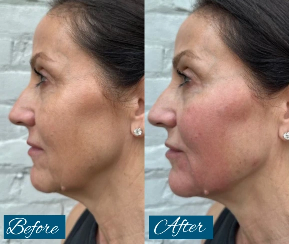 Before & After Results Banner