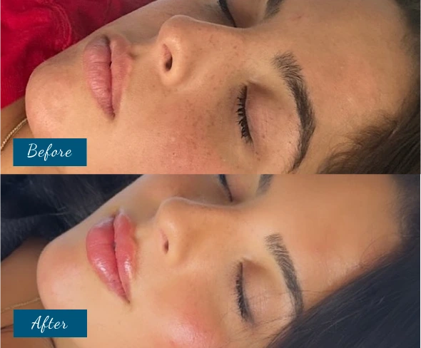 Before & After stunning results Banner