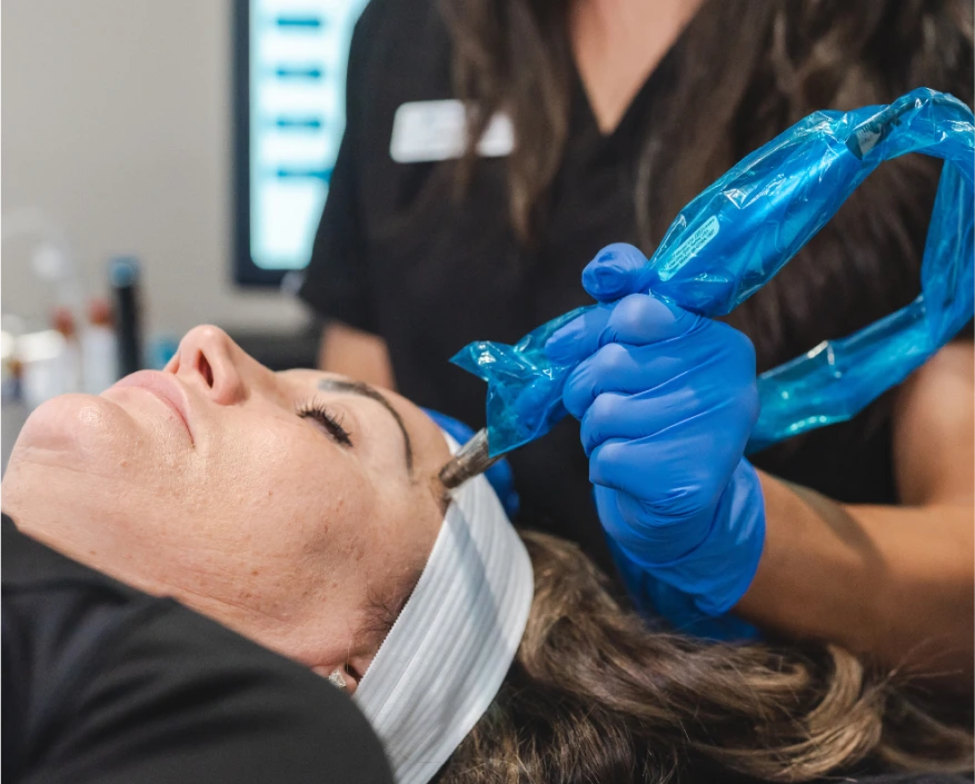 Marlboro NJ Facial Treatments: Microneedling Banner