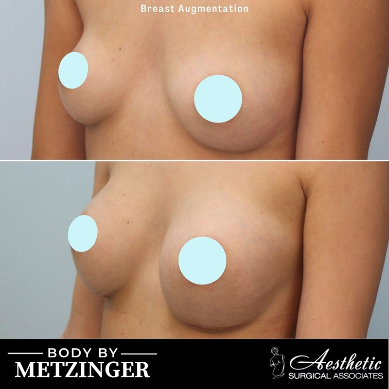 ASA B&A Library Retouched - 221