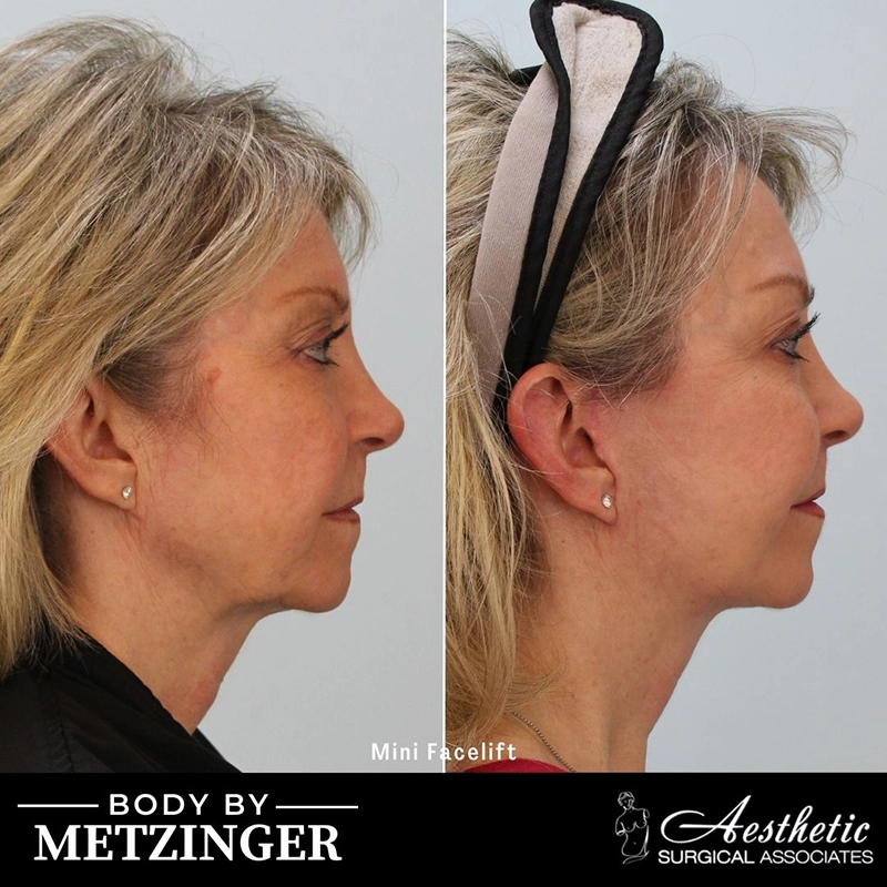 ASA B&A Library Retouched - 105