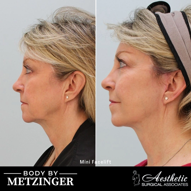 ASA B&A Library Retouched - 108