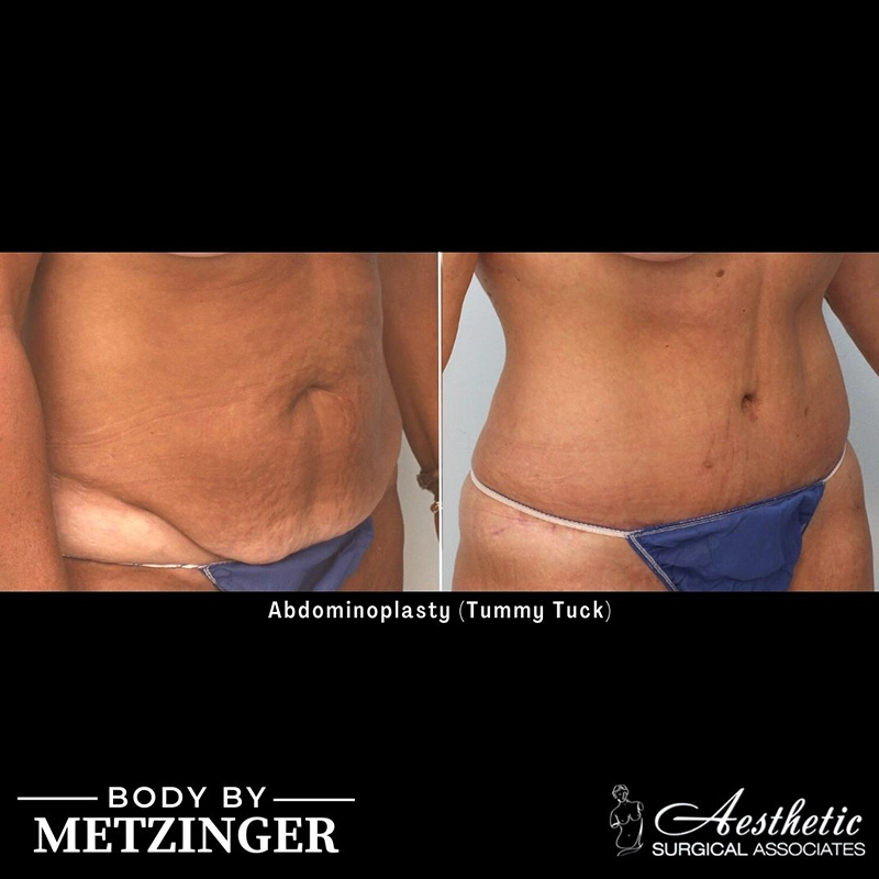 ASA B&A Library Retouched - 46