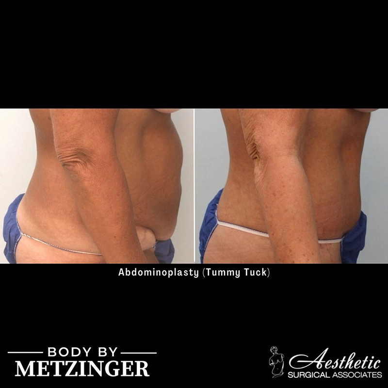 ASA B&A Library Retouched - 47