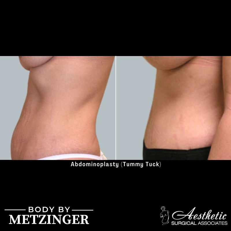 ASA B&A Library Overflow - 2